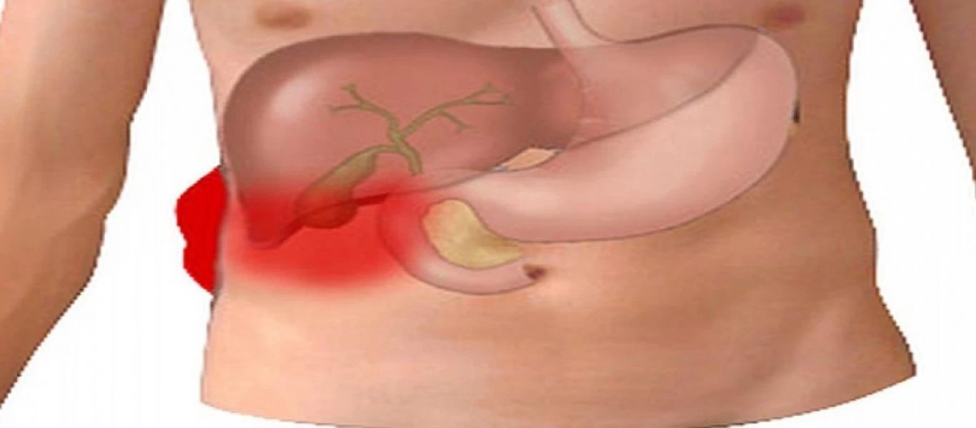 Τι είναι οι πέτρες στη χολή και πως τις αντιμετωπίζετε;
